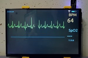 Open source patient monitor
