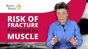 18K views · 57 reactions | What predicts fracture? That is a common...