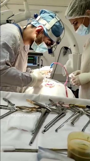 🟢Video of L5-S1 Surgery✍ Lumbar Microdiscectomy #spine #surgeryday #herniadedisco#neurosurgeon