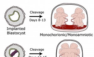 A tale of twin sisters