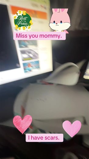 #missmymommy #fyp #baseball #scars #dreams