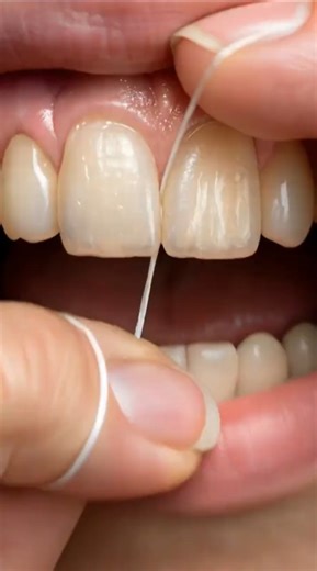 This Is How Floss Really Works
