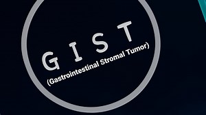 Gastrointestinal Stromal Tumor: Comprehensive Patient Guide | CURE