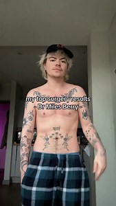 My top surgery results by Dr Miles Berry #ftm #trans #topsurgery | EzraButler
