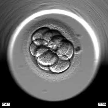 IVF Gynem Klinik - EmbryoScope - Entwicklung des Embryos