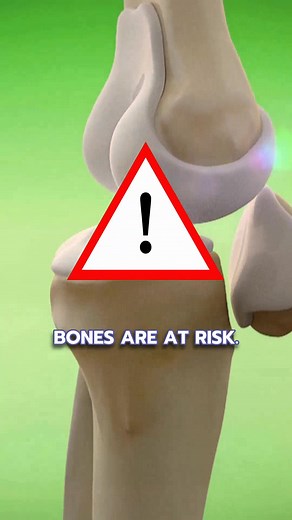 Enjoy the taste of BariBurst Calcium Citrate Soft Chews while supporting your bone health. Specially formulated for bariatric patients, each chew provides 500 mg of calcium citrate and 500 IU of vitamin D3. Easy, effective, and delicious – just what you need to stay strong and healthy post-surgery!  Use code WELCOME15 at checkout to get 15% off your 1st order. | Bari Life | Facebook