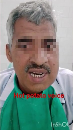 “Hot Potato Voice – Classic Sign of Peritonsillar Abscess!”