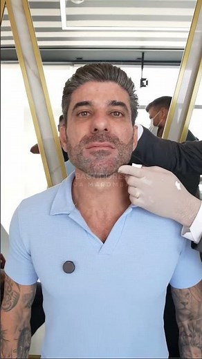 Brazilian Human Ken Doll: The Shocking Before and After!