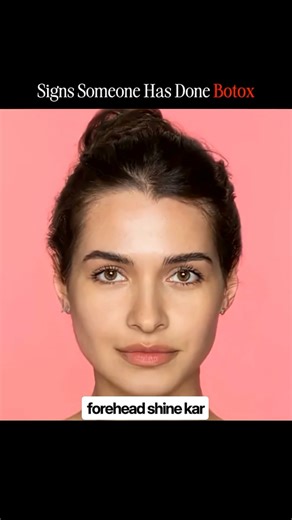 Signs Someone Has Done Botox?