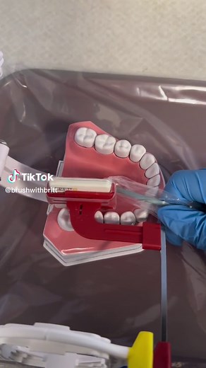 Tips for Taking Bite Wings with XCP Rings