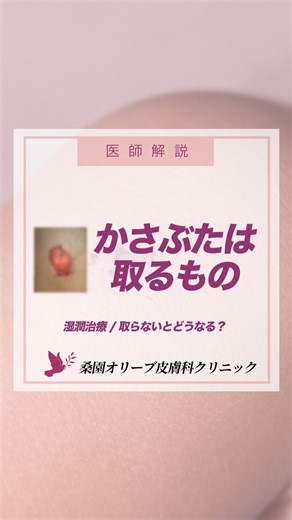 桑園オリーブ皮膚科クリニック on Instagram: "「かさぶた」はどうしていますか？ 「取った方が良い理由」をお話ししました。 #かさぶた #札幌皮膚科 #桑園オリーブ皮膚科クリニック #皮膚科 #オリーブ皮膚科"