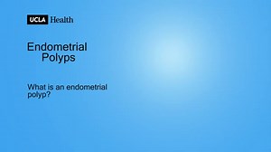 What is an Endometrial Polyp?