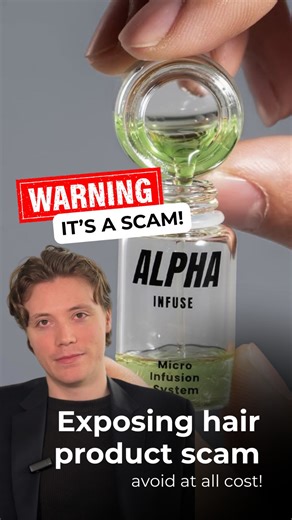 Vinci Hair Clinic Dubai on Instagram: "SCAM ALERT: ALPHA INFUSE - hair loss solution We’ve had multiple people contact us about a product called Alpha Infuse after seeing aggressive ads online promising miracle hair regrowth. After investigating, we found serious red flags and want to spread the awareness before this scam can get to you. • No clinical trials • No medical proof • No evidence of real hair restoration from the product, photos and videos are of people who had hair transplants to res