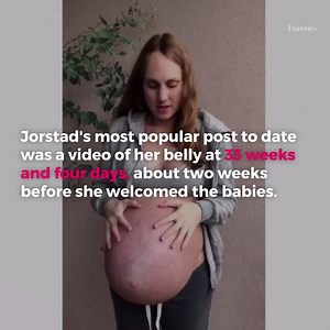 1.4M views · 2.1K reactions | What's it like to be pregnant with triplets? This new mom documented her pregnancy journey on Instagram and the photos are stunning. Read the full story here: https://trib.al/PyB7dnt | Parents | Facebook