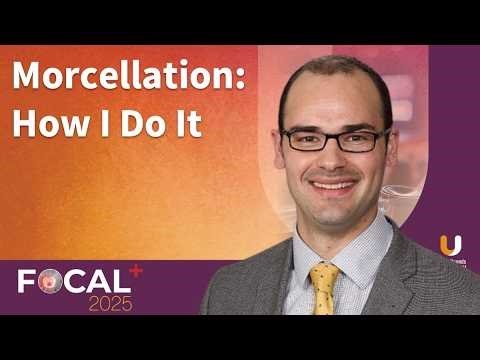 Treatment of Benign Prostatic Hyperplasia: Morcellation - How Dr. Rivera Does It