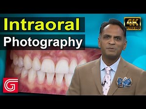 How to Take Intraoral Dental Photos by Presh B. Patel, DDS