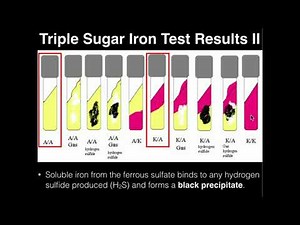Microbiology: Triple Sugar Iron Agar