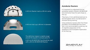 BI-MENTUM Surgical Technique & Instrument Guide