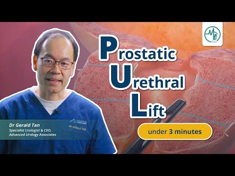 DON'T Get Prostatic Urethral Lift (PUL) Before You Watch This Video | Dr Gerald Tan (Urologist)