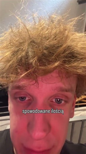 A was obchodzi wygląd innych?
