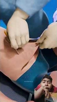 How Excess Skin Removal Surgery Works #shorts #facts