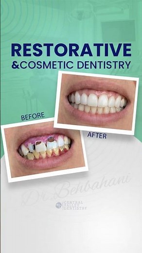 Restorative and Cosmetic Dentistry Result | Full Smile Transformation