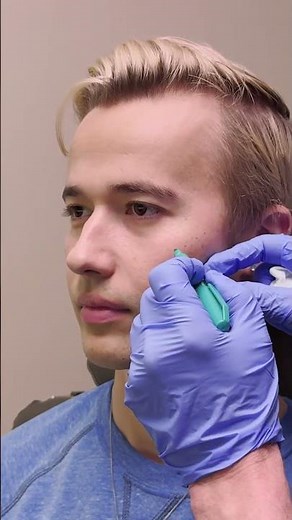 Male Model Makeover by Dr. Douglas Steinbrech | Male Plastic Surgery