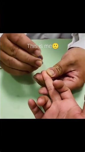 Injection fails😂😂 #epic #injection #fails #funny #funnyvideo #shorts #like #share #subscribe #doctor