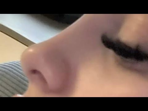 ⊹ ࣪ ˖ EMERGENCY nose reduction ₓ lifted tip, slim nose, rib rhino, tiny nostrils [ 1 𝒽𝓇 RESULTS ] 💉