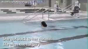 Three lower limb surgeries that you need to know about. | The Surgery