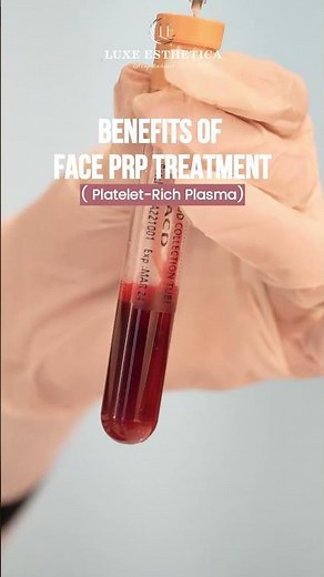 Why PRP Facial Is Trending 🔥 Real Skin Benefits Explained