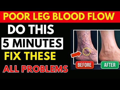 Poor Leg Circulation? 3 Easy & FAST Exercises + 30-Second Test