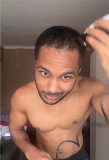 Shaving My Head: Going Bald — Why I Decided to Cut the Top