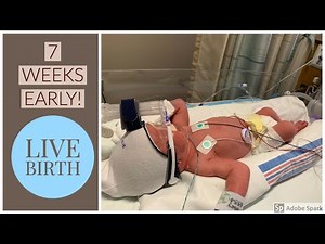 33 WEEK LABOR AND DELIVERY VLOG | MY WATER BROKE AT 33 WEEKS PREGNANT
