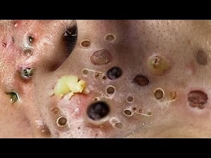 Satisfying videos for Relaxation with XINH SPA CHANNEL 5 #175