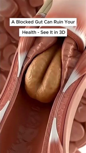 the Hidden Truth About your Colon Health