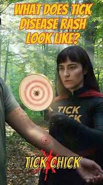 What does a tick-borne disease rash look like?