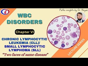 CLL & SLL Made Simple | Pathology, Diagnosis, and Treatment Overview