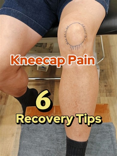 KneeCap Pain! 6 Tips for Recovery #runnersknee #kneecappain #chondromalaciapatella #patellofemoralpainsyndrome #kttape