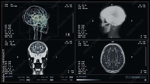Diagnostic system deals with organ examination by scanning head. Diagnostic examination of the human organs. Medical diagnostic software thoroughly examining the damaged patients brain organ. X-ray.