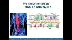 Everything a Neurologist Needs to Know About NMO & MOG