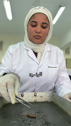 😭😭🪳🪳🪳 #anatomy #zoology #insect #cairouniversity #biotechnology #fyp #fypシ #fypシ゚viral #trendingvideo #trending #fyp