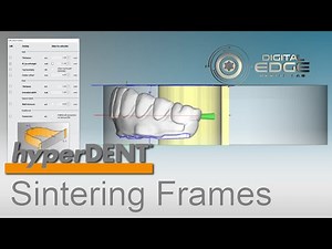 hyperDENT Tutorial Time Saving Tip: Editing Sintering Frames