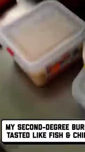 🎬 Malfunctioning Deep Fryer Explodes Unexpectedly