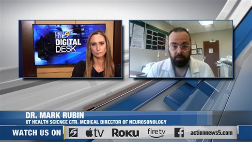 How new stroke technology is changing the game for doctors