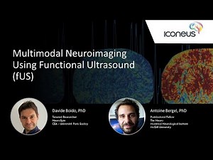 Multimodal Neuroimaging Using Functional Ultrasound (fUS)