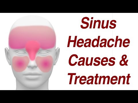 Sinus Headaches: Causes & Treatment