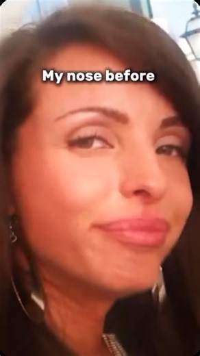 Anastasiia Burdiug on Instagram: "By working with facial muscles, you can actually change your nose. The change occurs by engaging the muscles around the nose. Do this exercise every day for 20-30 repetitions. I explain this exercise in detail in my Super Face course  ✅ Watch free lesson from my course via the link in bio @takeclass.superface"