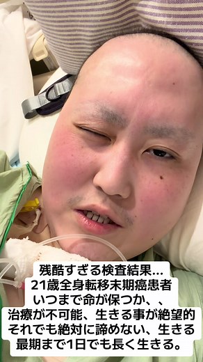 全身転移末期がんの検査結果と治療開始 — 生きると闘う21歳の記録