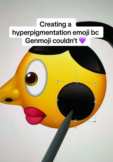 Creating a Unique Hyperpigmentation Emoji for Artists